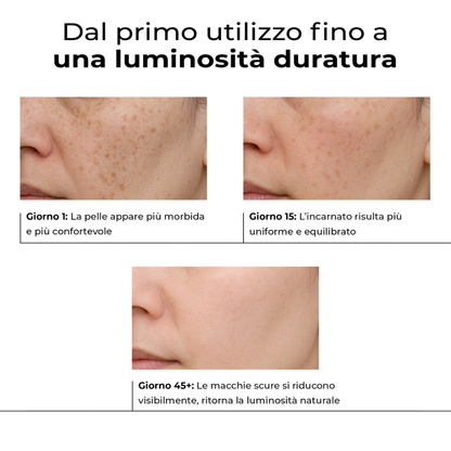 Progressi con il siero Lumisilk dal giorno 1 al giorno 45: pelle più morbida, incarnato uniforme e riduzione visibile delle macchie scure.